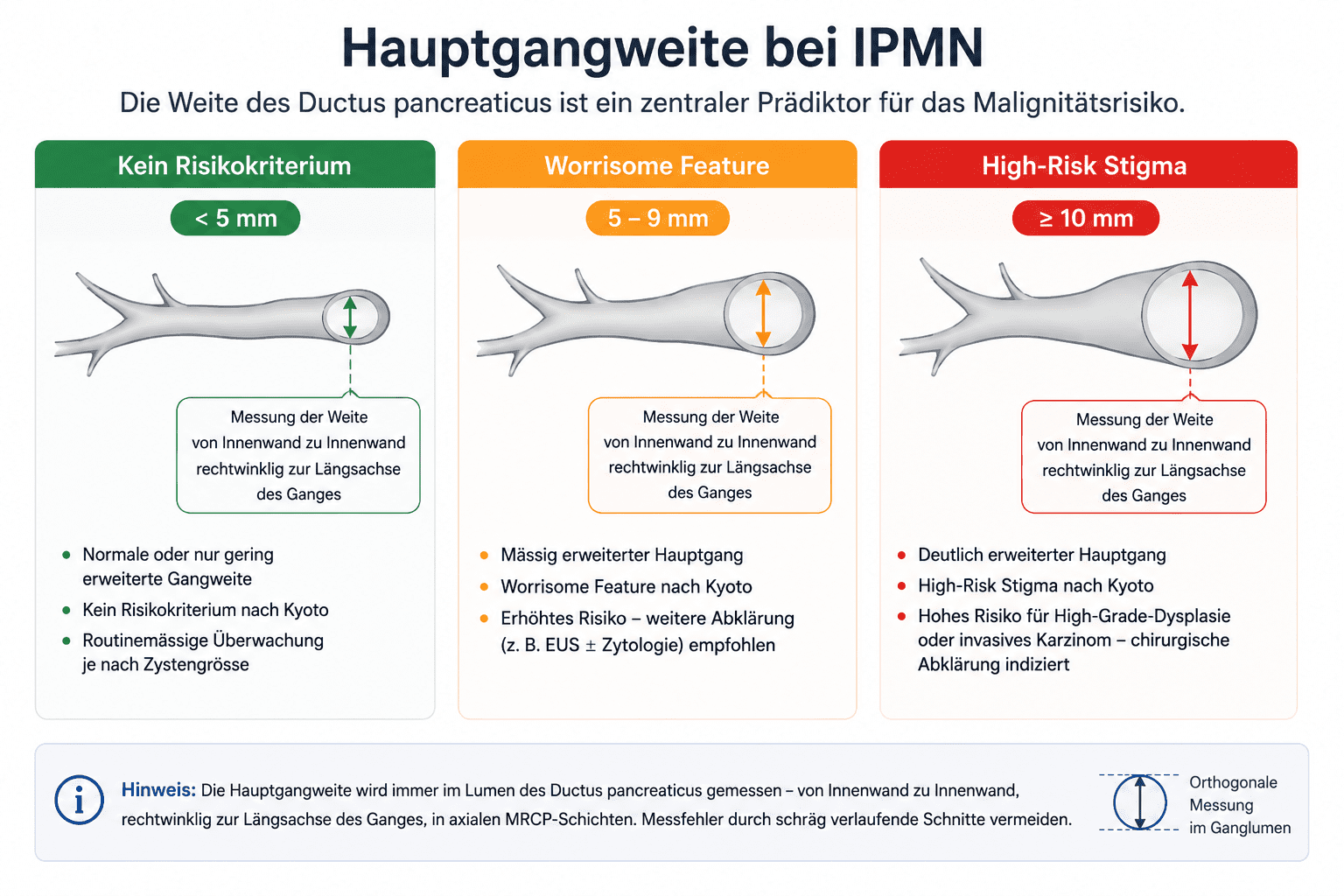 KI-generierte Infografik zur Hauptgangweite bei IPMN mit schematischer Darstellung der korrekten Messung des Ductus pancreaticus von Innenwand zu Innenwand. Vergleich der Risikokategorien < 5 mm, 5–9 mm und ≥ 10 mm nach der Kyoto-Klassifikation.
