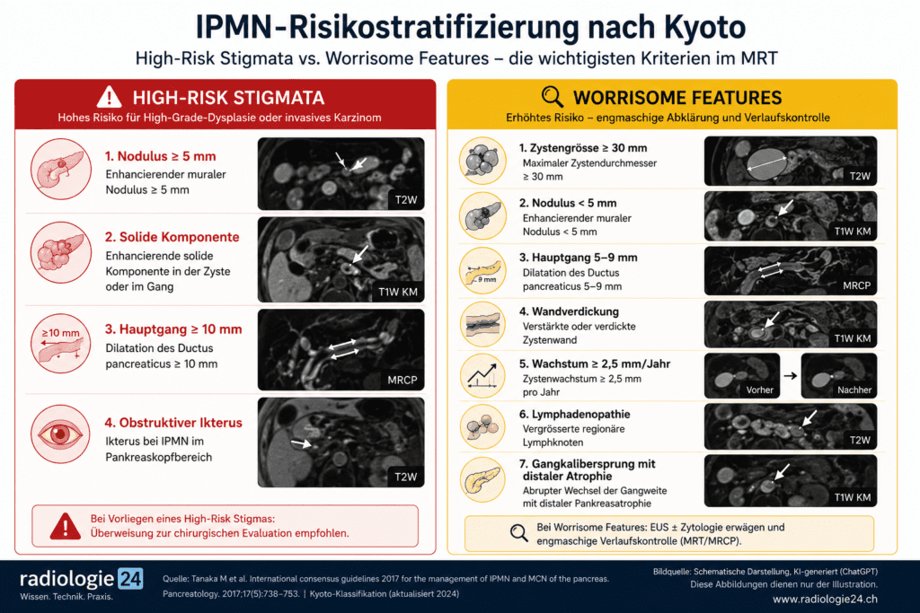 KI-generierte Infografik zur Risikostratifizierung von IPMN im MRT nach der Kyoto-Klassifikation. Gegenüberstellung von High-Risk Stigmata und Worrisome Features mit schematischen MRT-Beispielen und den wichtigsten radiologischen Risikokriterien.