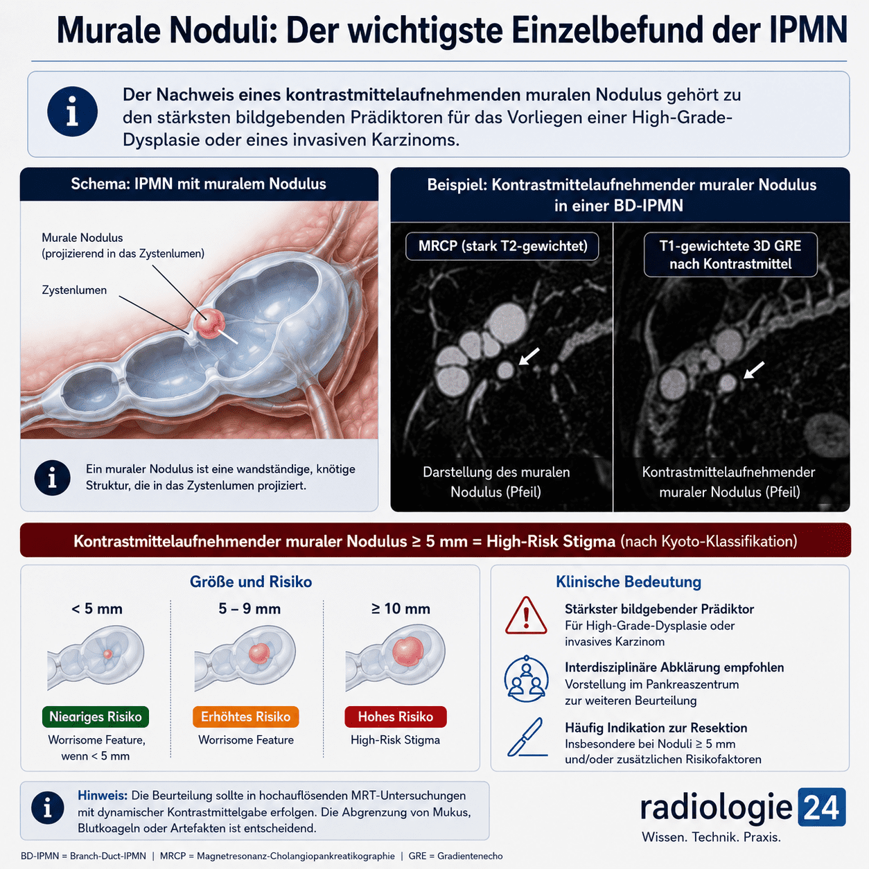 KI-generierte Infografik zur Bedeutung muraler Noduli bei IPMN. Darstellung eines kontrastmittelaufnehmenden muralen Nodulus in einer zystischen Pankreasläsion mit MRT-Beispielen, Grössenklassifikation und Risikobeurteilung nach der Kyoto-Klassifikation.