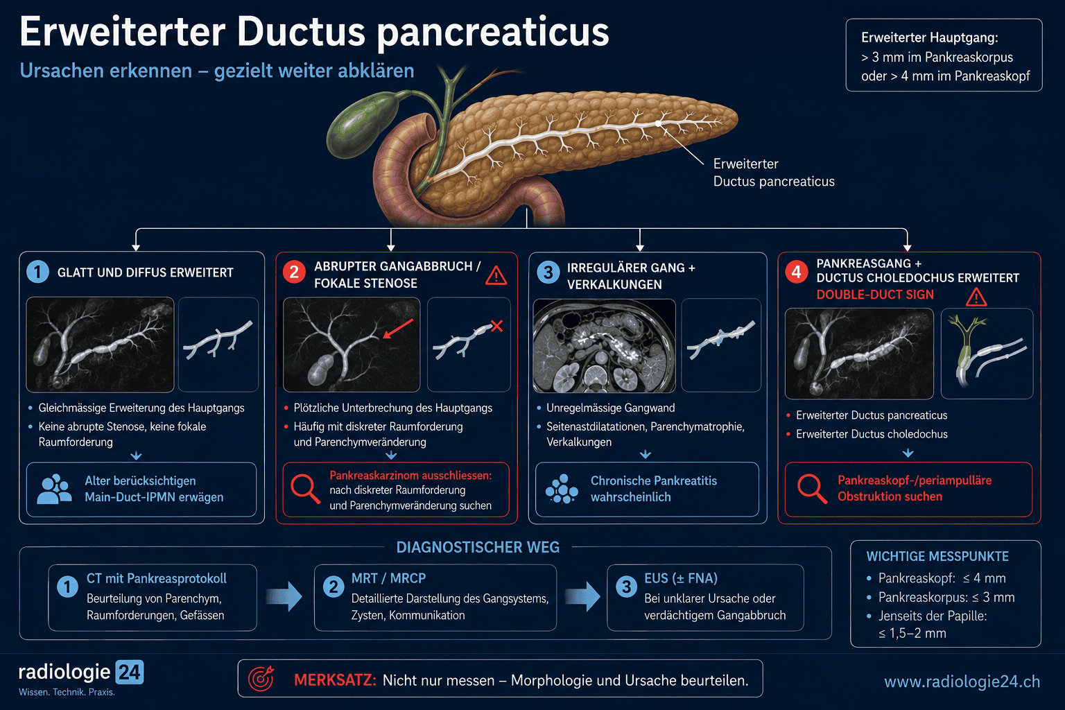 Radiologischer Entscheidungsweg bei erweitertem Ductus pancreaticus mit typischen Bildmustern und weiterführender Diagnostik.